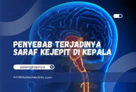 Ciri-Ciri Saraf Kejepit di Kepala, Kenali Penyebab dan Pengobatannya